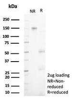 NECAB1/EF-hand calcium binding protein 1 Antibody in SDS-PAGE (SDS-PAGE)