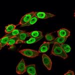 SET Antibody in Immunocytochemistry (ICC/IF)