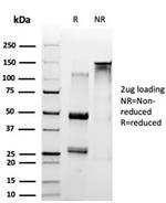 SET Antibody in SDS-PAGE (SDS-PAGE)