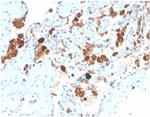 Pulmonary Surfactant-Associated Protein D (SFTPD) Antibody in Immunohistochemistry (Paraffin) (IHC (P))