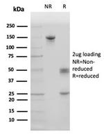 Pulmonary Surfactant-Associated Protein D (SFTPD) Antibody in SDS-PAGE (SDS-PAGE)