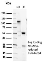 Pulmonary Surfactant-Associated Protein D (SFTPD) Antibody in SDS-PAGE (SDS-PAGE)