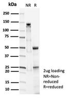 Pulmonary Surfactant-Associated Protein D (SFTPD) Antibody in Immunoelectrophoresis (IE)