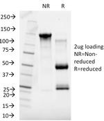 Sex Hormone Binding Globulin (SHBG) Antibody in SDS-PAGE (SDS-PAGE)