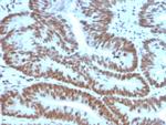 BMI1 Antibody in Immunohistochemistry (Paraffin) (IHC (P))