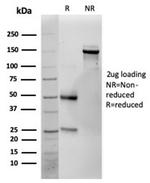 Interleukin-25 (IL-25)/IL-17E Antibody in SDS-PAGE (SDS-PAGE)