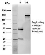 Interleukin-25 (IL-25)/IL-17E Antibody in Immunoelectrophoresis (IE)