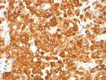 gp100/Melanosome/PMEL17/SILV (Melanoma Marker) Antibody in Immunohistochemistry (Paraffin) (IHC (P))