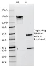 gp100/Melanosome/PMEL17/SILV (Melanoma Marker) Antibody in SDS-PAGE (SDS-PAGE)