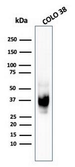 gp100/Melanosome/PMEL17/SILV (Melanoma Marker) Antibody in Western Blot (WB)