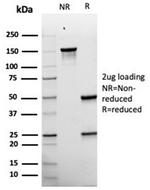 gp100/Melanosome/PMEL17/SILV (Melanoma Marker) Antibody in Immunoelectrophoresis (IE)