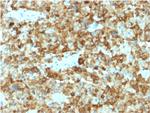 gp100/Melanosome/PMEL17/SILV (Melanoma Marker) Antibody in Immunohistochemistry (Paraffin) (IHC (P))