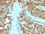 gp100/Melanosome/PMEL17/SILV Antibody in Immunohistochemistry (Paraffin) (IHC (P))