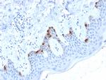 gp100/Melanosome/PMEL17/SILV Antibody in Immunohistochemistry (Paraffin) (IHC (P))