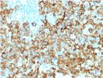 gp100/Melanosome/PMEL17/SILV (Melanoma Marker) Antibody in Immunohistochemistry (Paraffin) (IHC (P))