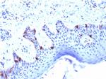 gp100/Melanosome/PMEL17/SILV (Melanoma Marker) Antibody in Immunohistochemistry (Paraffin) (IHC (P))