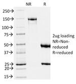 gp100/Melanosome/PMEL17/SILV (Melanoma Marker) Antibody in SDS-PAGE (SDS-PAGE)