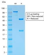 gp100/Melanosome/PMEL17/SILV Antibody in SDS-PAGE (SDS-PAGE)