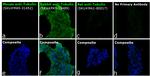 Rabbit IgG (H+L) Secondary Antibody in Immunocytochemistry (ICC/IF)