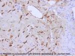 Plakophilin 2 Multiepitope Antibody in Immunohistochemistry (IHC)