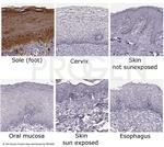 KRT9 Antibody in Immunohistochemistry (IHC)