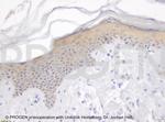 Plakophilin 3 Antibody in Immunohistochemistry (IHC)