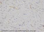 Desmoglein 2 Antibody in Immunohistochemistry (IHC)