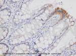 Desmoglein 2 Antibody in Immunohistochemistry (IHC)