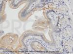 Desmoglein 2 Antibody in Immunohistochemistry (IHC)