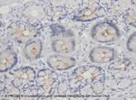 Desmoglein 2 Antibody in Immunohistochemistry (IHC)