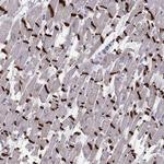 Plakophilin 2 Antibody in Immunohistochemistry (IHC)