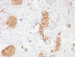 GLUT-1 Antibody in Immunohistochemistry (Paraffin) (IHC (P))