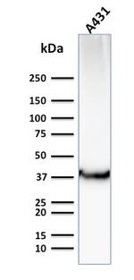 GLUT-1 Antibody in Western Blot (WB)