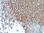 GLUT-1 (Tumor Progression and Mesothelioma Marker) Antibody in Immunohistochemistry (Paraffin) (IHC (P))