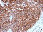 GLUT-1 Antibody in Immunohistochemistry (Paraffin) (IHC (P))