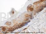 Plakophilin 1 Antibody in Immunohistochemistry (IHC)