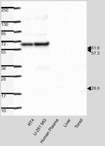 Nucleolar Helicase Antibody in Western Blot (WB)