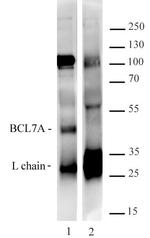 Bcl7A Antibody in Immunoprecipitation (IP)