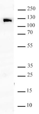 NAT10 Antibody in Western Blot (WB)