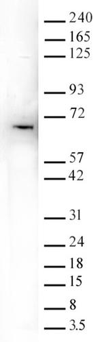 YTHDF1 Antibody in Western Blot (WB)