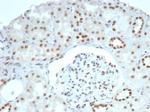 BRG1/SMARCA4 Antibody in Immunohistochemistry (Paraffin) (IHC (P))