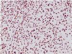 Integrase interactor 1 (INI-1)/SNF5/SMARCB1 Antibody in Immunohistochemistry (Paraffin) (IHC (P))