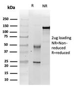 Integrase interactor 1 (INI-1)/SNF5/SMARCB1 Antibody in SDS-PAGE (SDS-PAGE)