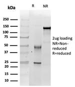 Integrase interactor 1 (INI-1)/SNF5/SMARCB1 Antibody in Immunoelectrophoresis (IE)