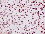 Integrase interactor 1 (INI-1)/SNF5/SMARCB1 Antibody in Immunohistochemistry (Paraffin) (IHC (P))