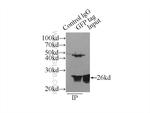 GFP tag Antibody in Immunoprecipitation (IP)