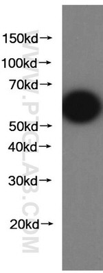 GFP tag Antibody in Western Blot (WB)