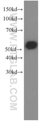 GFP tag Antibody in Western Blot (WB)