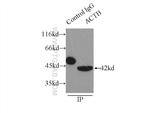 beta Actin Antibody in Immunoprecipitation (IP)