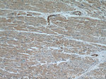 beta Actin Antibody in Immunohistochemistry (Paraffin) (IHC (P))